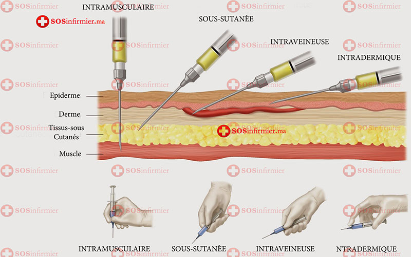 Les différents types d'injections à domicile à Casablanca